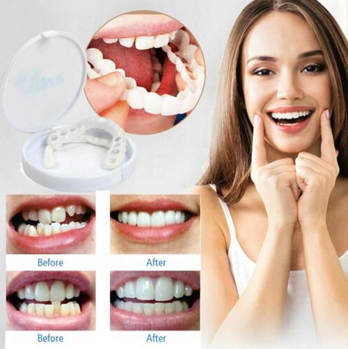 Preciashopping Veneers Snap in Teeth, Snap On Upper Teeth Veneers Comfort Fit Flex Fits Denture ...